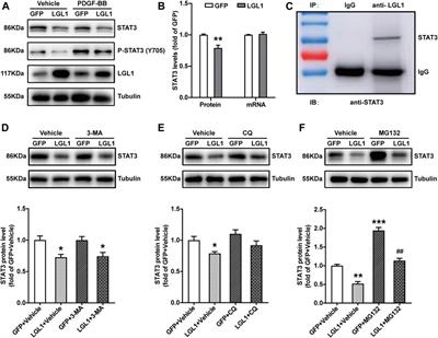 Deletion of Smooth Muscle Lethal Giant Larvae 1 Promotes Neointimal Hyperplasia in Mice